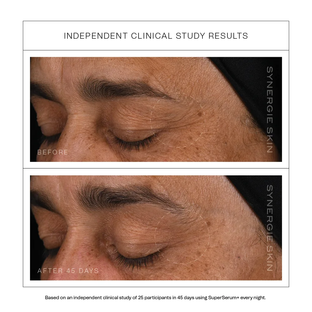 SuperSerum__Clinicaldatacarousel12