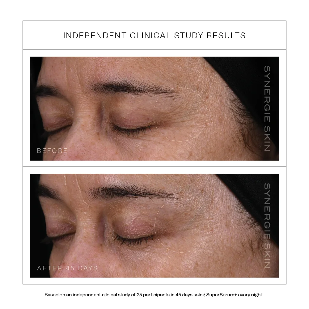 SuperSerum__Clinicaldatacarousel13